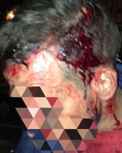Imagen de un policía herido en la misma noche del suceso.