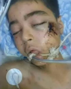 Ali Daqneesh, de 10 años, cuando fue ingresado en en un hospital de Aleppo/REUTERS