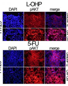 La localización de pAKT, una proteína crucial en el ciclo celular de células con daños en su ADN, analizada por inmunofluorescencia. / IDIBELL