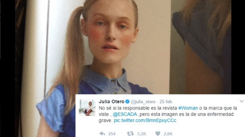 Esto no es un ideal de belleza, es "la imagen de una enfermedad grave" Esto no es un ideal de belleza, es "la imagen de una enfermedad grave"