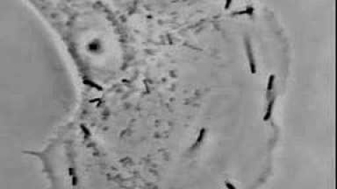 Listeria monocytogenes Listeria monocytogenes