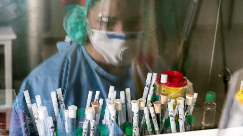 Tubos con muestras para análisis. EFE Tubos con muestras para análisis. EFE