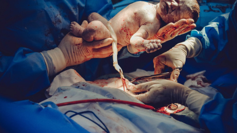 Pexels/Vidal Balielo, CC BY-SA Pexels/Vidal Balielo, CC BY-SA