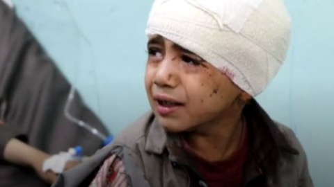 Víctima de uno de los ataques de Arabia Saudí en Yemen. Víctima de uno de los ataques de Arabia Saudí en Yemen.