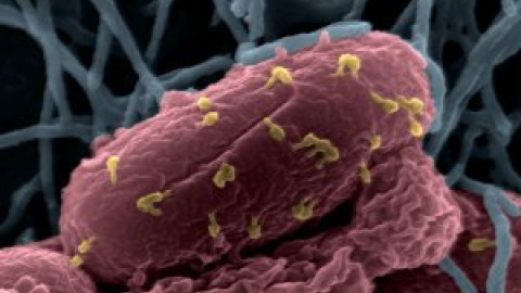 Los científicos se preguntan si los grandes virus son organismos vivos Los científicos se preguntan si los grandes virus son organismos vivos