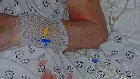 Llagas en el cuerpo de Juan Abuín Llagas en el cuerpo de Juan Abuín