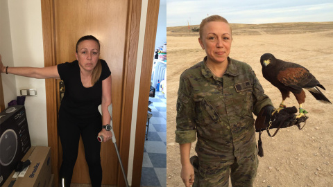 Ana S. G. no puede desplazarse hoy sin muletas. / Cedidas