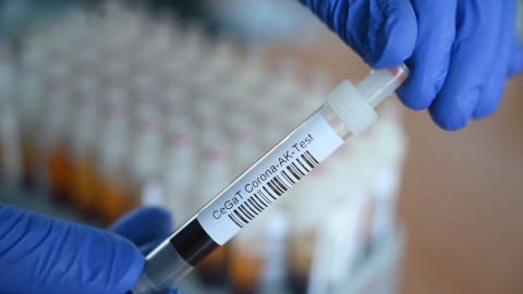 La pandemia de coronavirus supera los 30 millones de casos con más de 946.000 muertos La pandemia de coronavirus supera los 30 millones de casos con más de 946.000 muertos