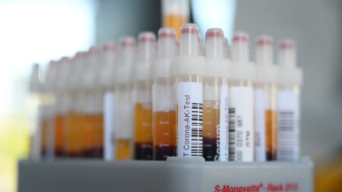 El coronavirus deja más de 23,2 millones de casos a nivel mundial El coronavirus deja más de 23,2 millones de casos a nivel mundial