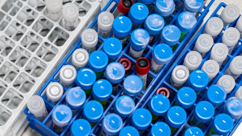 Imagen de archivo de un laboratorio. REUTERS/Cooper Neill. Imagen de archivo de un laboratorio. REUTERS/Cooper Neill.