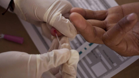 Detalle de la mano de hombre que se realiza la prueba del VIH | EFE/Archivo Detalle de la mano de hombre que se realiza la prueba del VIH | EFE/Archivo
