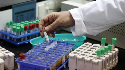 Imagen de un laboratorio de prueba contra la covid-19. Imagen de un laboratorio de prueba contra la covid-19.