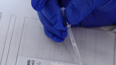Realización de test rápido de PCR Realización de test rápido de PCR