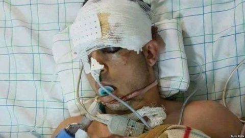 Imagen del joven fallecido durante su estancia en el hospital, difundida por varios medios marroquíes. Imagen del joven fallecido durante su estancia en el hospital, difundida por varios medios marroquíes.