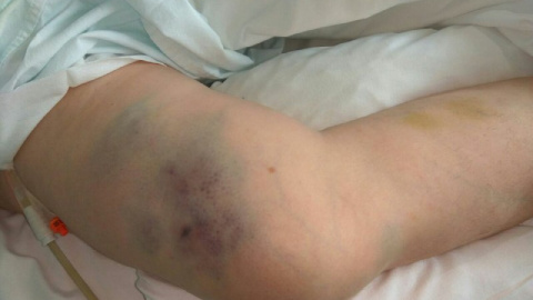 Accidentes de ancianos en una residencia de San Sebastián de los Reyes. / Izquierda Independiente Accidentes de ancianos en una residencia de San Sebastián de los Reyes. / Izquierda Independiente