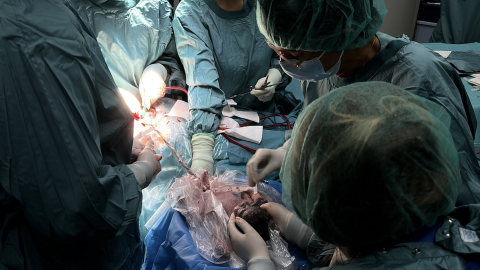 19-7-2023 Els sanitaris assisteixen un part a l'hospital de Sant Pau de Barcelona 19-7-2023 Els sanitaris assisteixen un part a l'hospital de Sant Pau de Barcelona