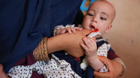 09/07/2023 - Nahida (8 meses) es examinada por desnutrición por Save The Children. 09/07/2023 - Nahida (8 meses) es examinada por desnutrición por Save The Children.
