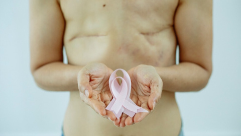 Una mujer sostiene el lazo rosa, símbolo de la lucha contra el cáncer de mama. Una mujer sostiene el lazo rosa, símbolo de la lucha contra el cáncer de mama.