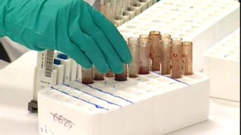 ¿Cuáles son los síntomas de la gripe porcina? ¿Cuáles son los síntomas de la gripe porcina?