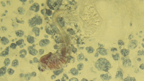 Un gusano bellota Un gusano bellota