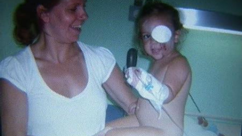 Una niña de dos años, operada tras sufrir el ataque de un perro en un camping Una niña de dos años, operada tras sufrir el ataque de un perro en un camping