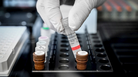 Obtienen el mapa genómico completo del SARS-CoV-2 Obtienen el mapa genómico completo del SARS-CoV-2