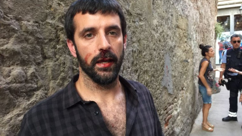 Jordi Borràs, después de la agresión. Imagen cedida por 'El Món'/QS Jordi Borràs, después de la agresión. Imagen cedida por 'El Món'/QS