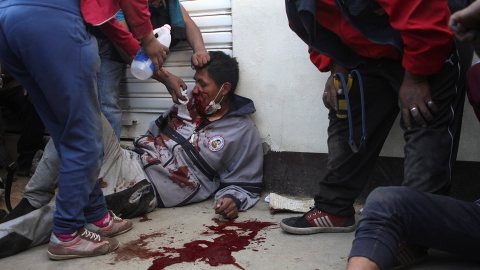 Los manifestantes ayudan a un hombre herido durante los enfrentamientos cerca de la planta de gasolina en Senkata, en las afueras de El Alto, La Paz, Bolivia, el 19 de noviembre de 2019. REUTERS / Pablo Aneli