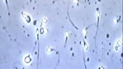 Nueces para mejorar la calidad del semen Nueces para mejorar la calidad del semen