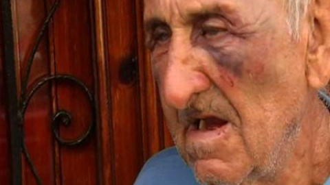 Anciano apaleado por dos ladrones en su propio domicilio Anciano apaleado por dos ladrones en su propio domicilio