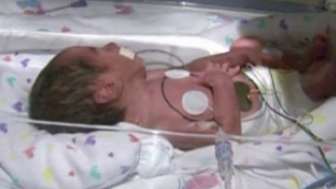 Una mujer estadounidense da a luz dos parejas de gemelos Una mujer estadounidense da a luz dos parejas de gemelos