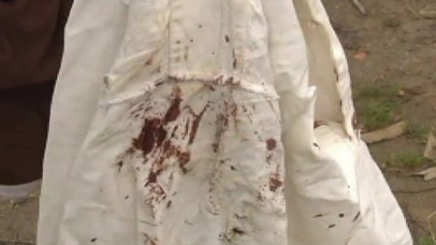 Una explosión de petardos hiere a los miembros de un grupo de música en La Coruña Una explosión de petardos hiere a los miembros de un grupo de música en La Coruña