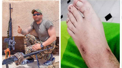 A la izquierda, el miliciano catalán encarcelado y torturado. A la derecha, detalle de la tortura a la que fue sometido en los pies A la izquierda, el miliciano catalán encarcelado y torturado. A la derecha, detalle de la tortura a la que fue sometido en los pies