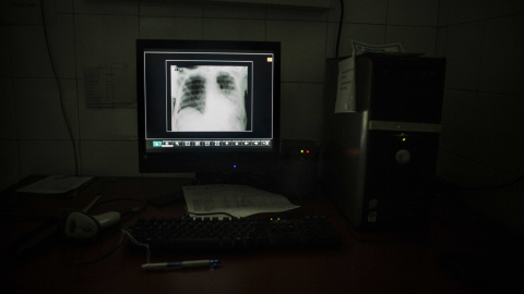 Un monitor donde se visualizan las radiografías en el Hospital Luis Razetti de Caracas, Venezuela.- JAIRO VARGAS
