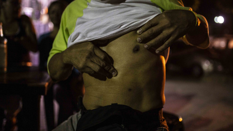Tirso Bolívar muestra la cicatriz de una herida de bala en la parroquia 23 de Enero de Caracas, Venezuela.- JARO VARGAS Tirso Bolívar muestra la cicatriz de una herida de bala en la parroquia 23 de Enero de Caracas, Venezuela.- JARO VARGAS