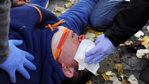 Uno de los heridos de la protesta contra un acto conmemorativo del 40 aniversario de la Constitución - EFE/Robin Townsend Uno de los heridos de la protesta contra un acto conmemorativo del 40 aniversario de la Constitución - EFE/Robin Townsend