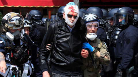 Un manifestante herido, antes de la manifestación del Primero de Mayo en París. / GONZALO FUENTES (REUTERS) Un manifestante herido, antes de la manifestación del Primero de Mayo en París. / GONZALO FUENTES (REUTERS)