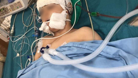 Abdul en el hospital de Nablus momentos después de ser operado. Abdul en el hospital de Nablus momentos después de ser operado.