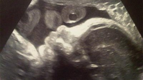 548b4f7854eda.jpg 548b4f7854eda.jpg