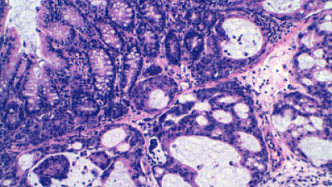 548c0f7b1dbff.jpg 548c0f7b1dbff.jpg