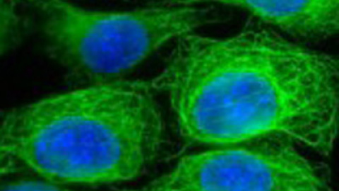 548b42fba86ab.jpg 548b42fba86ab.jpg