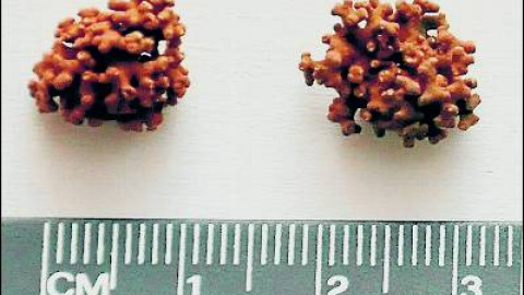 548b9df4f3fbb.jpg 548b9df4f3fbb.jpg