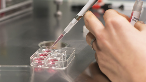 Proceso de vitrificación. / IVI Proceso de vitrificación. / IVI