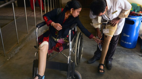 Rebeka, antigua trabajadora en el Rana Plaza, recibe la ayuda de un médico para colocarse sus prótesis. - AFP Rebeka, antigua trabajadora en el Rana Plaza, recibe la ayuda de un médico para colocarse sus prótesis. - AFP
