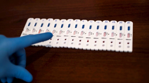 28/04/2020 - Test de diagnostico de la covid-19 en Córdoba. / EFE - RAFA ALCAIDE 28/04/2020 - Test de diagnostico de la covid-19 en Córdoba. / EFE - RAFA ALCAIDE