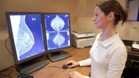 Las mujeres con cáncer de mama que utilizan suplementos dietéticos y terapias alternativas son menos propensas a iniciar tratamientos de quimioterapia. / Fotolia Las mujeres con cáncer de mama que utilizan suplementos dietéticos y terapias alternativas son menos propensas a iniciar tratamientos de quimioterapia. / Fotolia