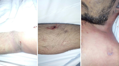 Imágenes facilitadas por la familia en el que se aprecian las presuntas pruebas de los malos tratos denunciados por la familia Fernández