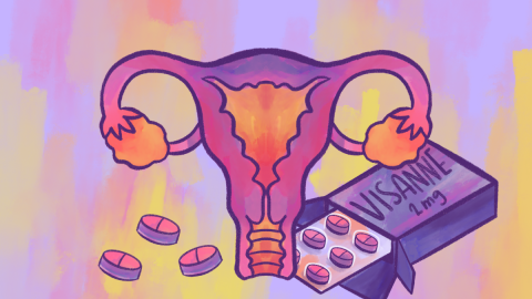 Ilustración sobre la endometriosis. Ilustración sobre la endometriosis.