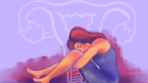 Ilustración sobre la endometriosis. Ilustración sobre la endometriosis.