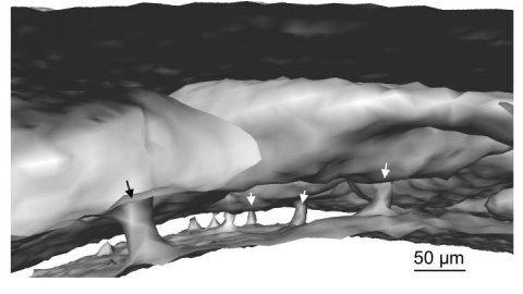 Imagen al microscopio de los canales vasculares existentes en un cráneo (señalados con flechas). /MASSACHUSETTS GENERAL HOSPITAL.